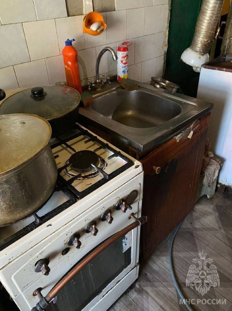 8-ми летний ребенок и его отец госпитализированы с ожогами