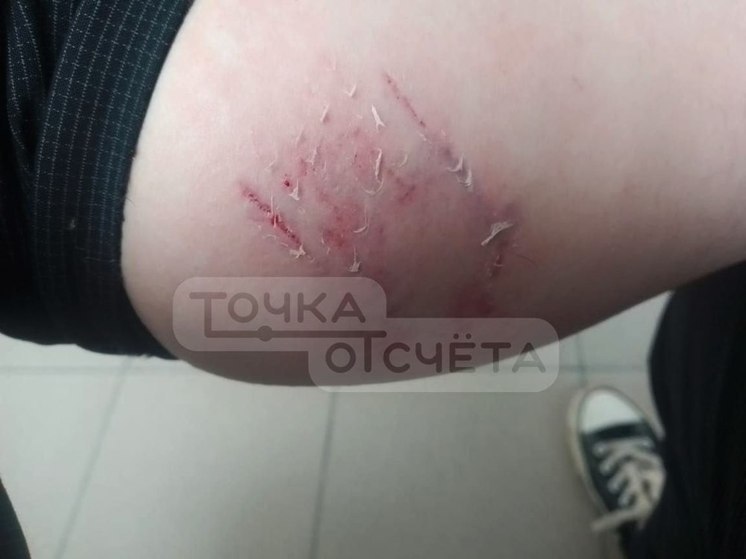 На Сахалине стая бездомных собак напала на девушку