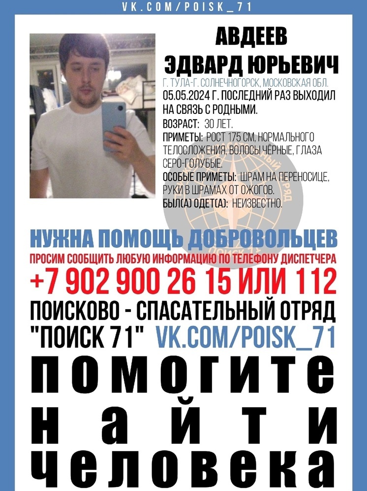 В Туле с 5 мая ищут 30-летнего мужчину с ожогами на руках