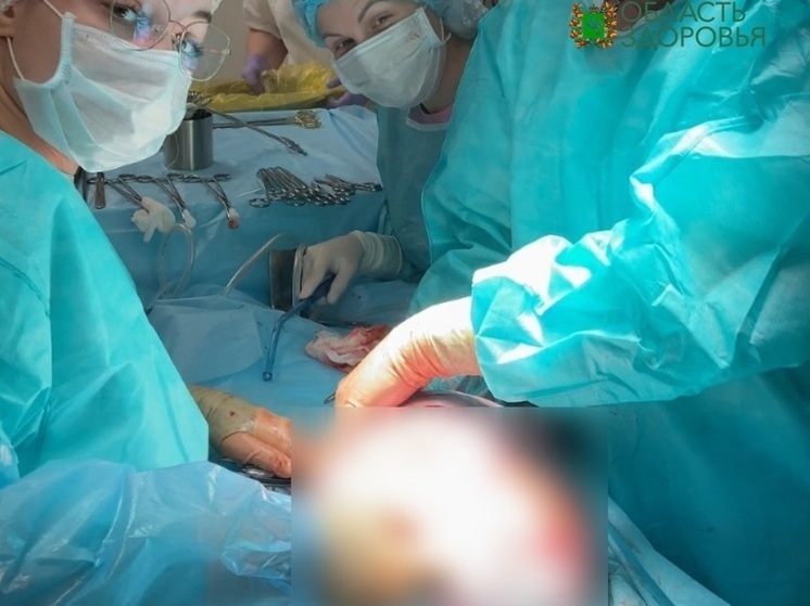 Томские хирурги-онкологи удалили у молодой пациентки гигантскую опухоль