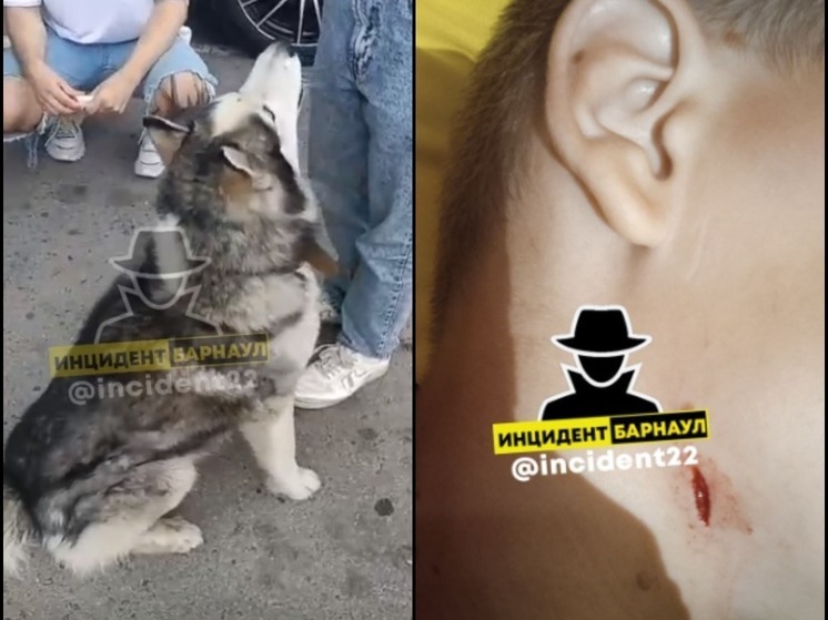 Соцсети: в Барнауле собака с ошейником вцепилась в шею ребенка