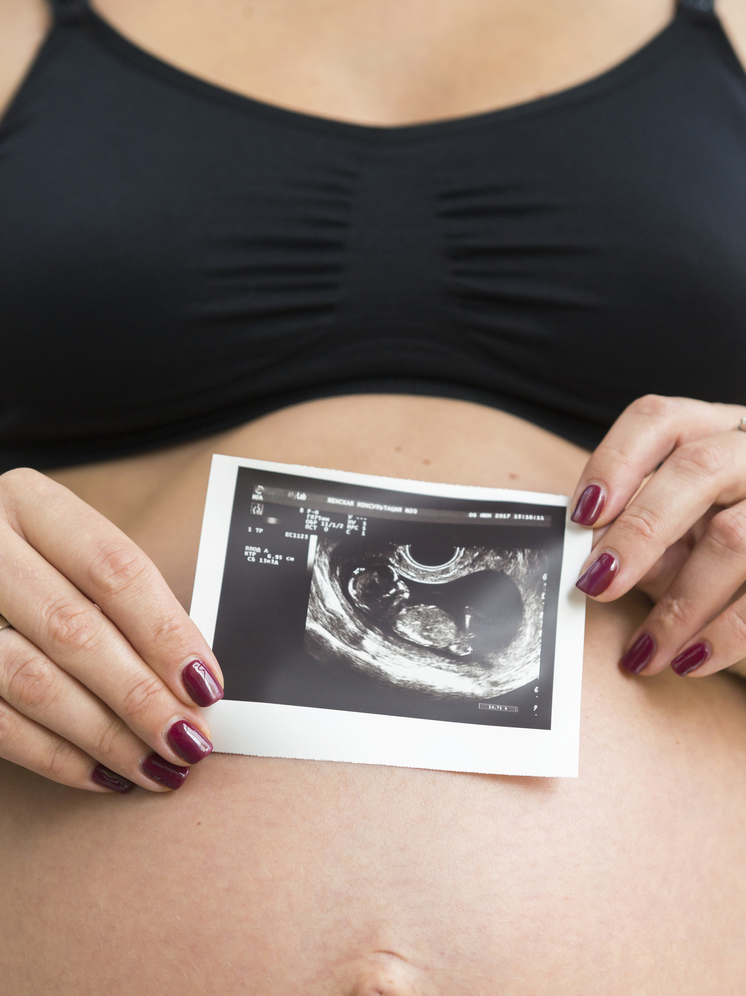 Голикова спрогнозировала снижение числа женщин репродуктивного возраста