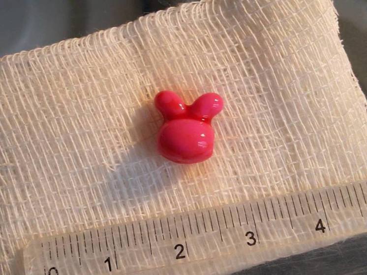 Пластиковую голову зайца достали медики из носа девочки 3 лет