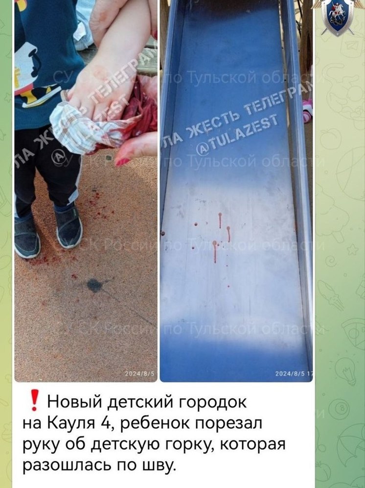 Тульские следователи выясняют обстоятельства травмирования ребенка на детской площадке