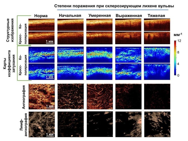В Нижнем успешно применили технологию ранней диагностики рака