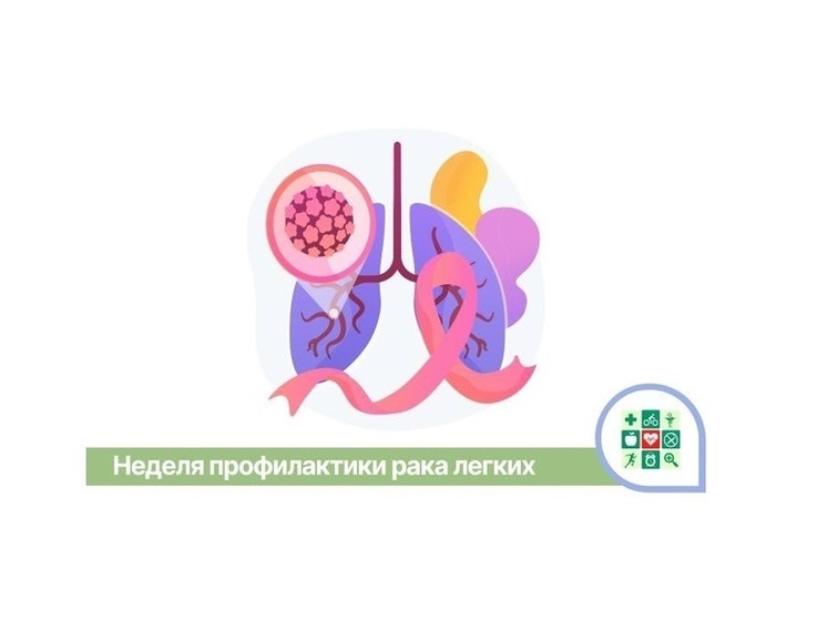 Неделя профилактики рака лёгких стартует в Краснодарском крае