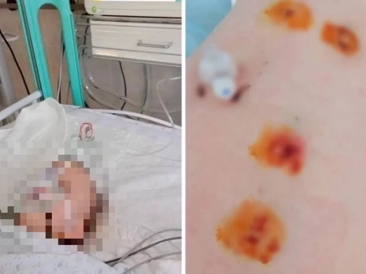 Столичная клиника отреагировала на заявление матери 3-летней девочки из Новосибирска о халатности врачей