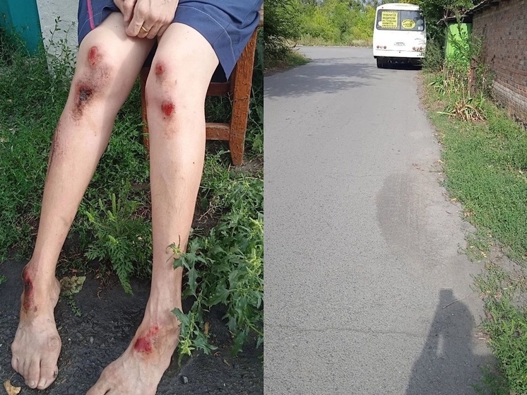 В Шахтах водитель автобуса защемил руку пассажирке и протащил ее по асфальту
