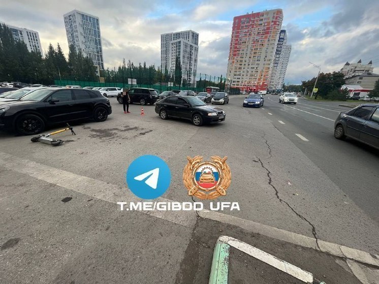 14-летняя девочка на электросамокате попала под машину