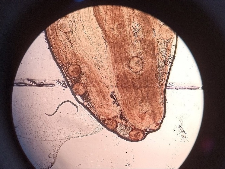 Личинки опасного паразита обнаружили в мясе псковского медведя