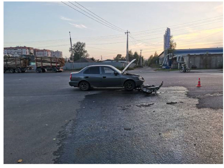 Юные питбайкеры получили травмы при ДТП в Вологде
