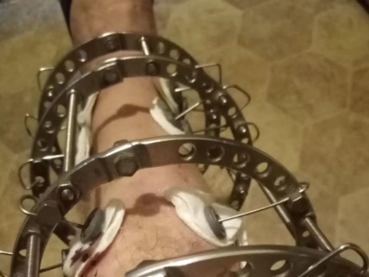 В Балашихе задержали местного жителя, избившего ветерана СВО