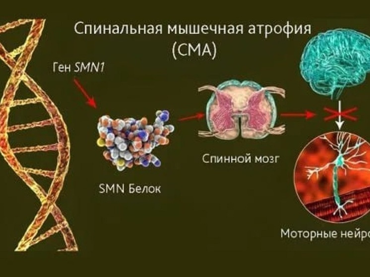 Нижегородские нейрохирурги смогли спасти тяжелобольного младенца