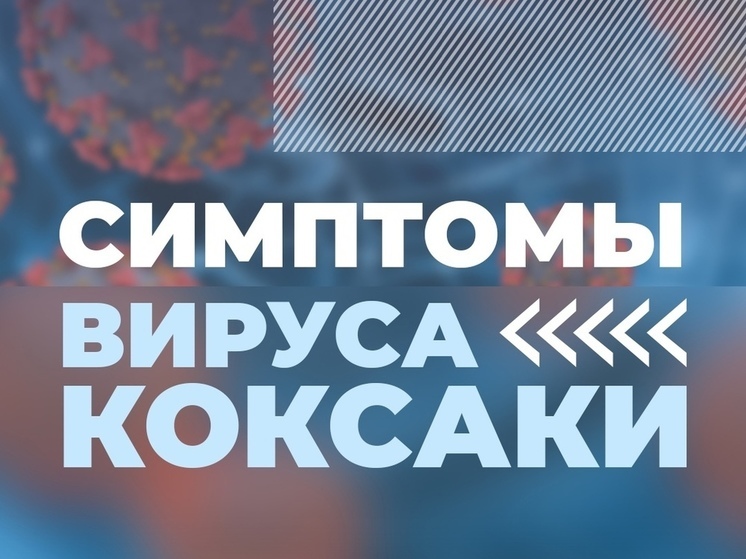 Псковичам рассказали о симптомах вируса Коксаки