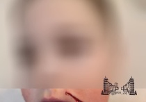 6 января в Красноярске произошел инцидент, в результате которого 12-летний мальчик был укушен собакой