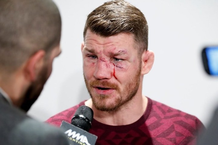 Майкл Биспинг рассказал, как травма глаза вынудила его завершить карьеру