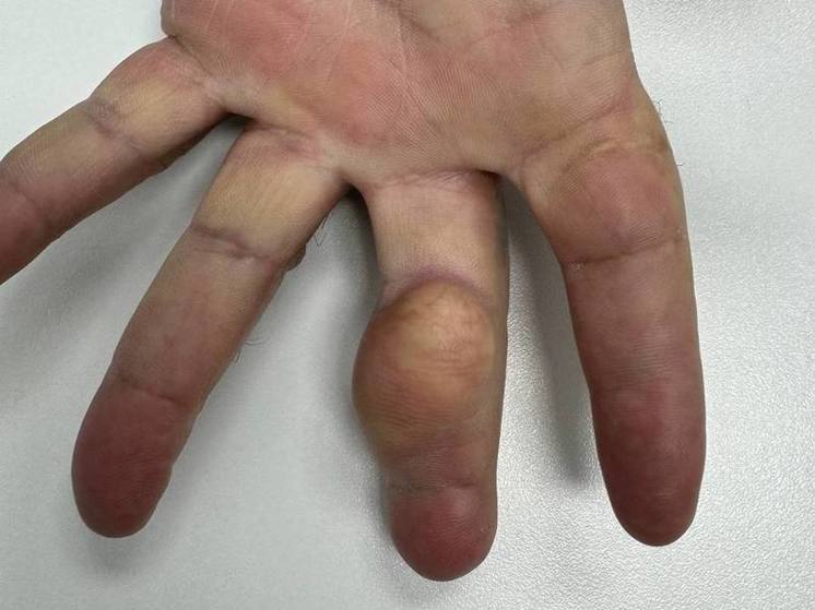 Спасать мужчину пришлось врачам