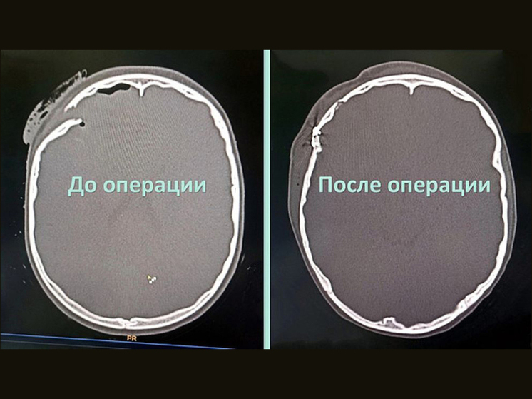 В начале января в Оричевском районе произошло серьёзное дорожно-транспортное происшествие: столкнулись два легковых автомобиля