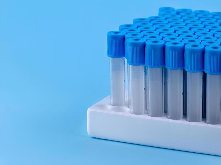 В Воронежской области зафиксировали снижение числа новых случаев ВИЧ-инфекции в 2024 году