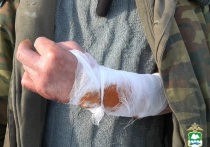 Участковый уполномоченный спас жителя села Ачикуль Белозерского муниципального округа, на которого напала собака