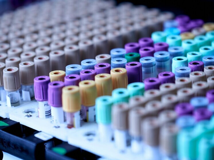 Жители ДНР могут бесплатно сдавать анализы примерно для 200 исследований