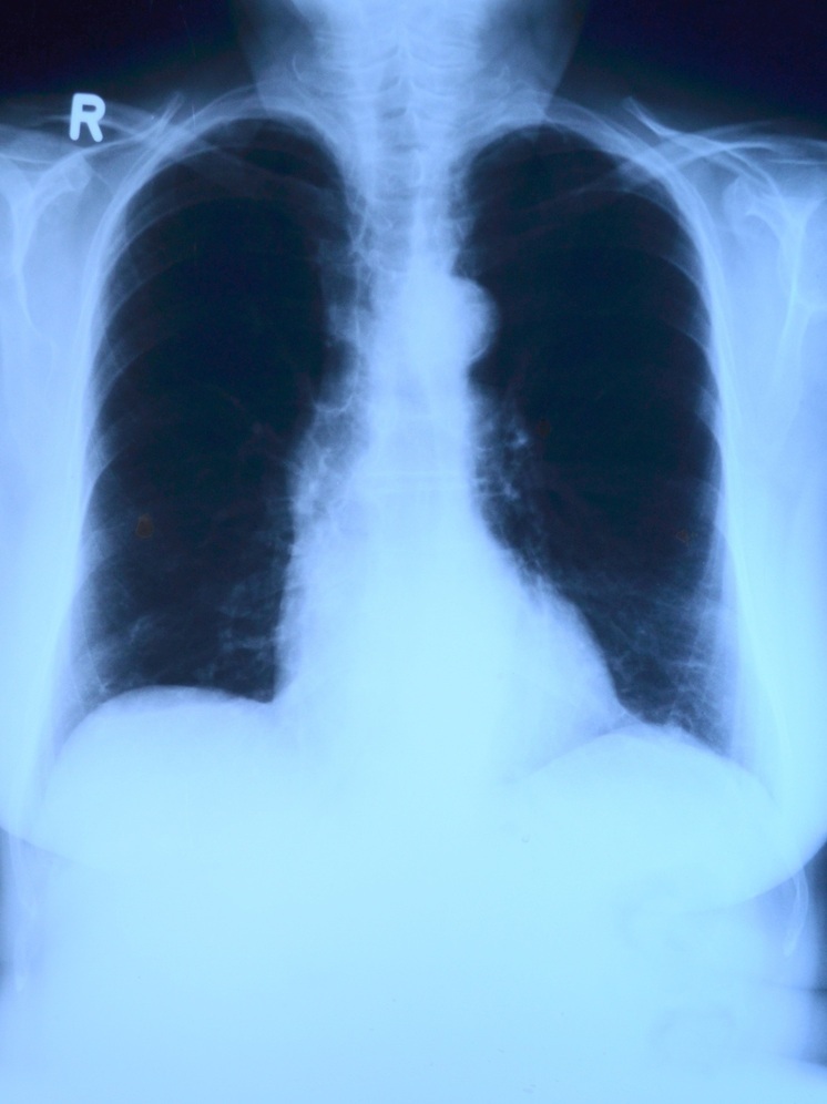 В ферзиковской участковой больнице обновят рентген-кабинет и стационар