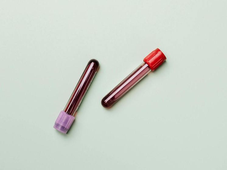 Этим людям не грозит даже рак: повезло носителям первой группы крови