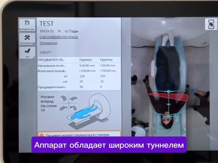 Новый КТ-аппарат появился в калужской онкологии