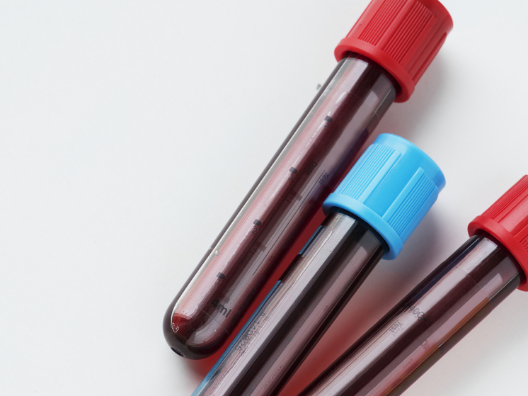 В Йошкар-Оле пройдёт донорская акция для обладателей военных билетов