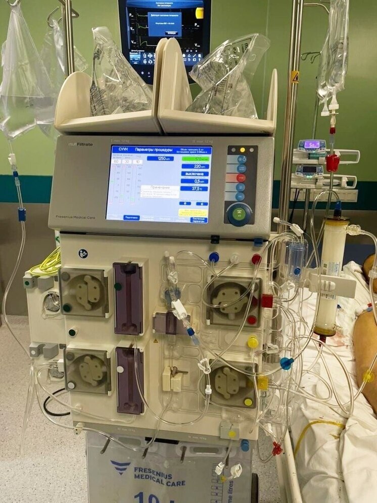 Благодаря уникальной методике в Калуге спасли тяжёлого пациента