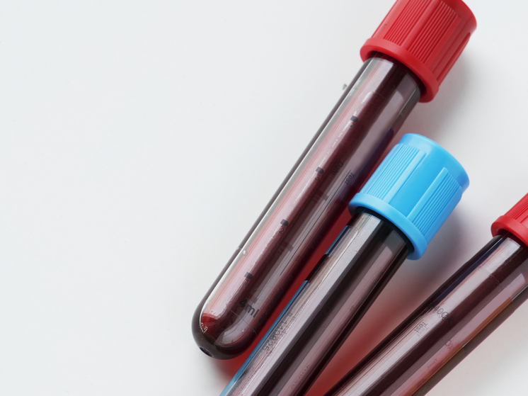 Учёные раскрыли тайну редкой крови: открыта новая группа спустя 50 лет