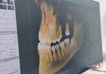 Светлые умы Японии тестируют препарат для выращивания новых зубов