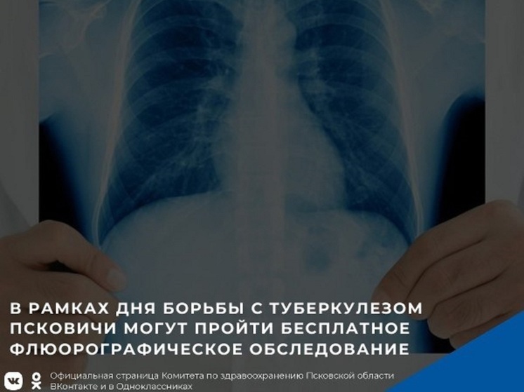 В рамках Дня борьбы с туберкулезом псковичи могут сделать бесплатную флюорографию