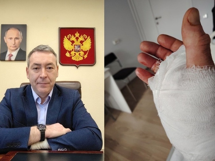 Мэр Энергодара Максим Пухов перенёс операцию на руке