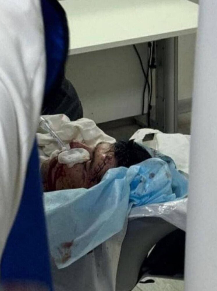 В Махачкале раненый полицейский нейтрализовал бандита его же ножом