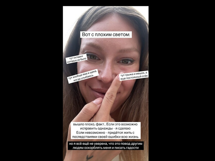 Рита Дакота пожаловалась на неудачную пластику и назвала подписчиц злыми