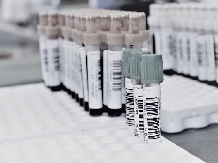 Падает или растет: Назван здоровый уровень сахара в крови для мужчин