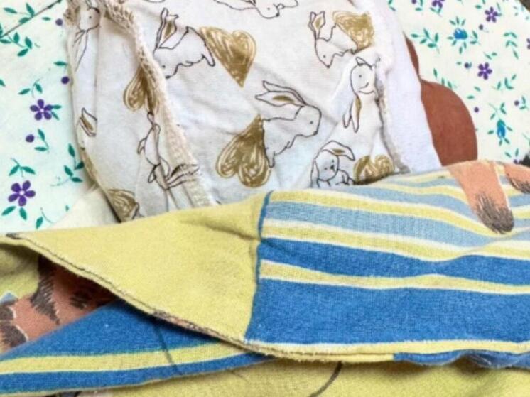 Рязанские врачи приняли роды у женщины с гигантской миомой матки