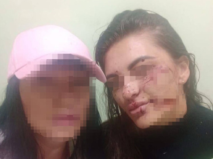 Суд вынес приговор жителю Бийска, который летом прошлого года в одном из ресторанов Белокурихи разбил стакан о лицо своей знакомой, а позже осколкам ударил мужчину, решившего заступиться за девушку