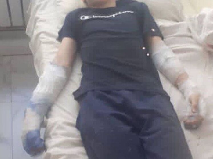 Мальчику в Махачкале ампутировали две пальцы после удара током