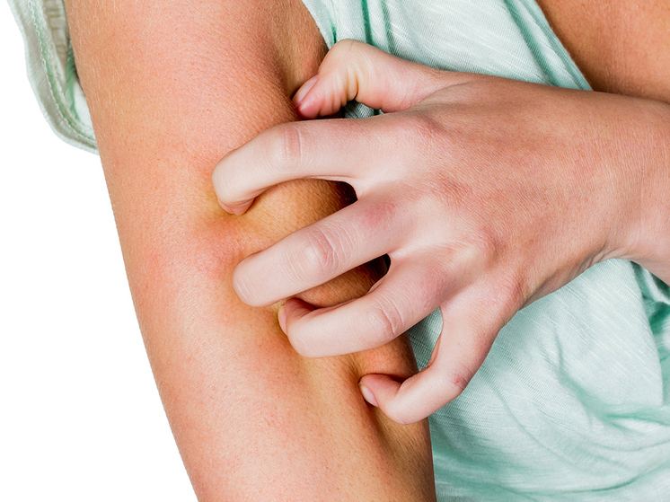 Ученые выяснили, что зоны риска рака кожи отличаются у мужчин и женщин