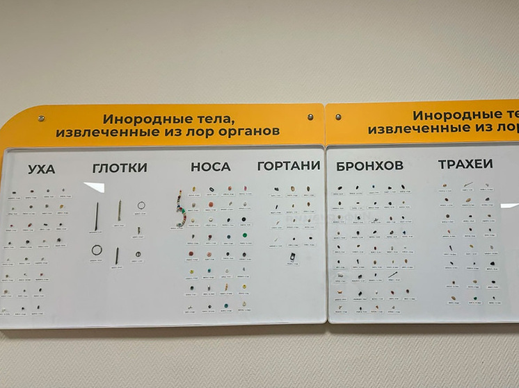 Воронежские оториноларингологи презентуют коллекцию извлеченных инородных предметов у детей