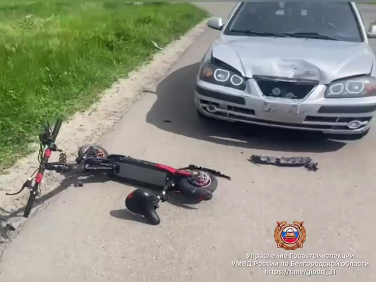 В Белгородском районе юный самокатчик угодил под колеса иномарки