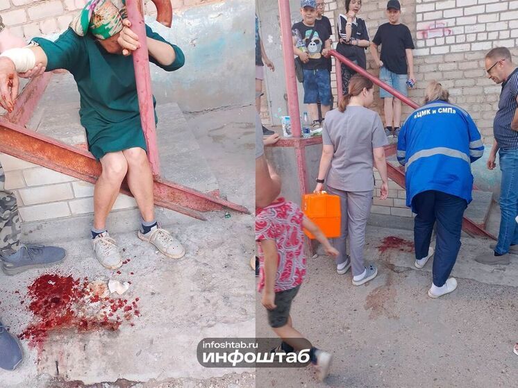 Вырвала кусок: агрессивная собака покусала бабушку в Астрахани