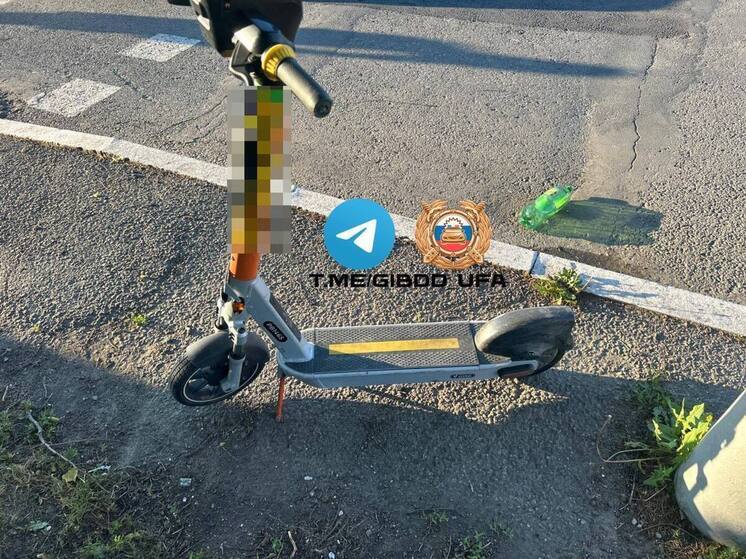 Двое подростков на электросамокате пострадали в ДТП с легковушкой