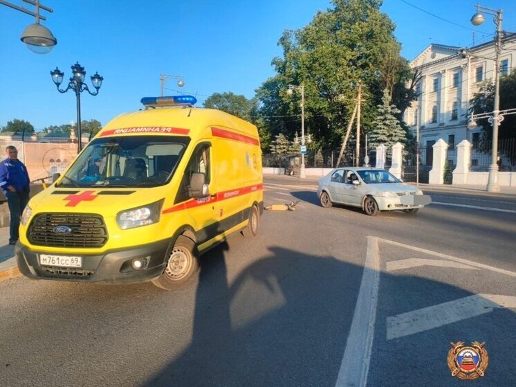 Два подростка на одном самокате попали под машину в центре Твери
