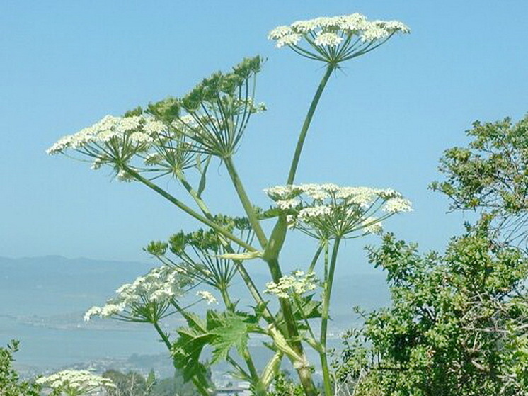 Sklifosovsky Research Institute Treats Man Who Received 80% Body Burns Due to Hogweed