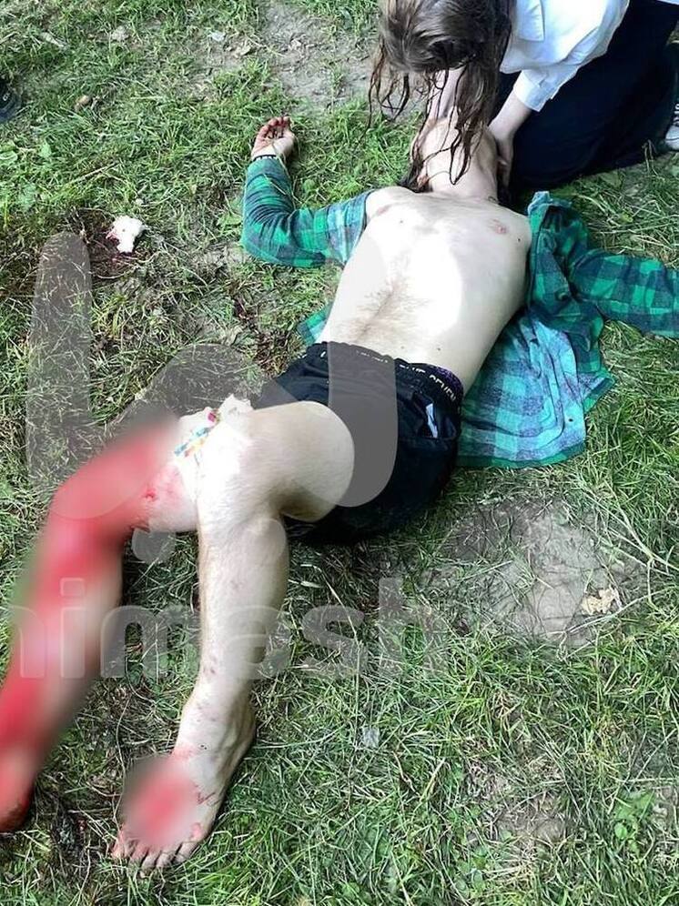 Нижегородец изрезал ножом подростка на Щёлоковском хуторе