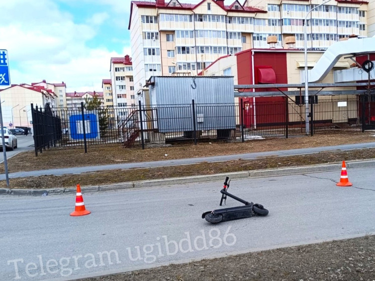 В Нижневартовске зафиксирован рост ДТП с участием электросамокатов