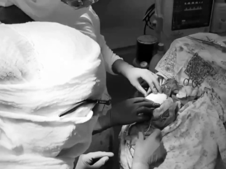 В Югре впервые провели операцию на черепе с использованием 3D-технологий